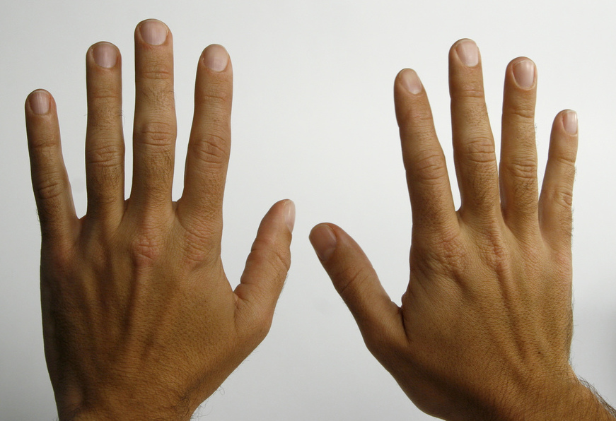 A photograph of two hands side-by-side, with palms facing away.